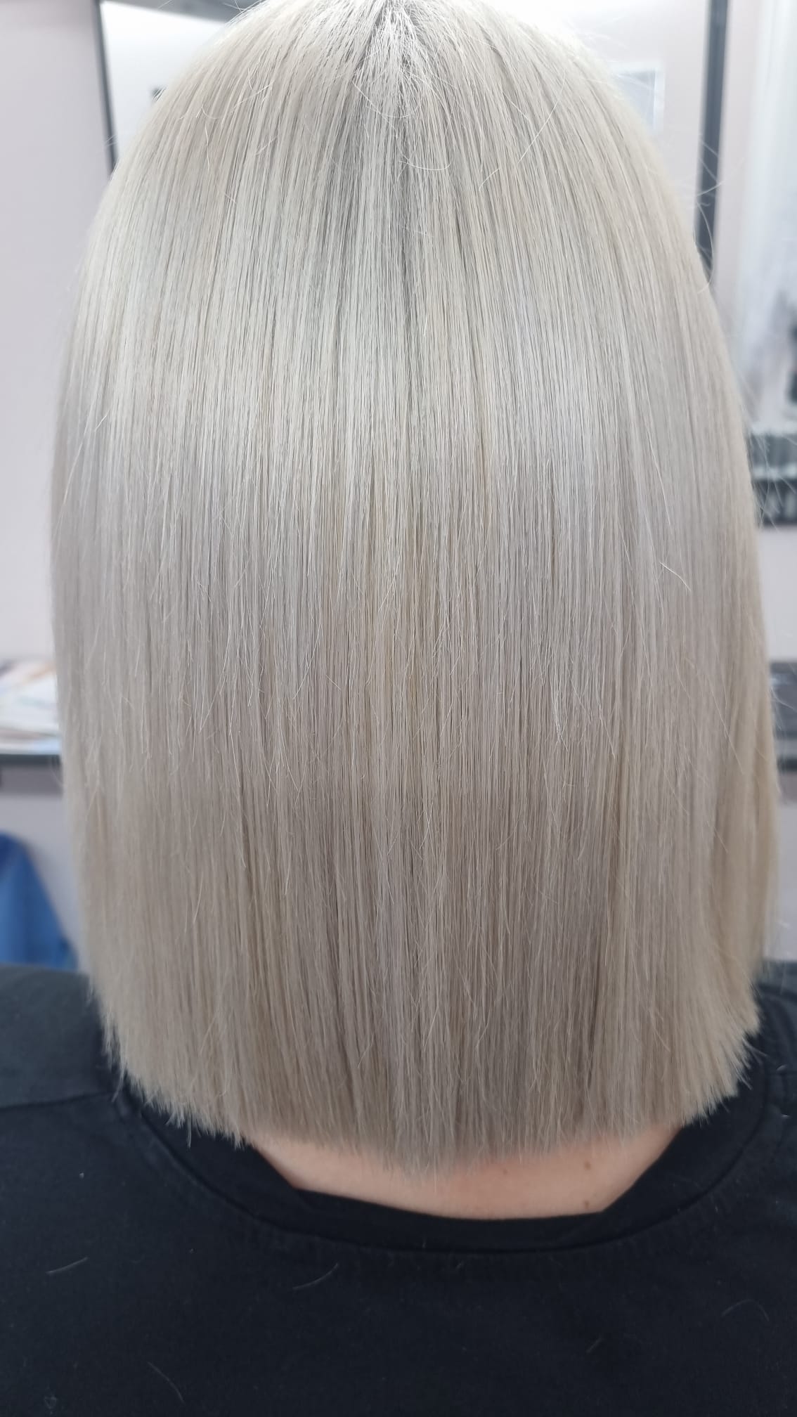 Botox Platinum Bielefeld Nachher